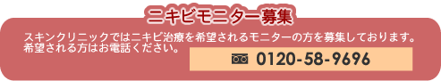 ニキビモニター募集 スキンクリニックではニキビ治療を希望されるモニターの方を募集しております。希望される方はお電話ください。0120-58-9696